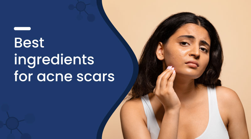best ingredients for acne scars