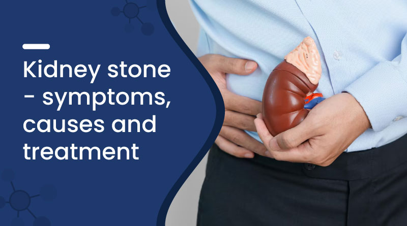 Kidney Stone - Symptoms, Causes and Treatment