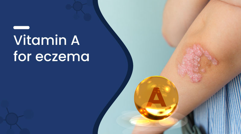 Vitamin A for Eczema &ndash; Benefits, Uses & Skin Healing Support