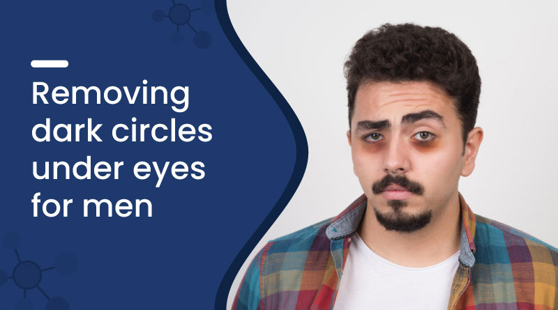 How to Remove Dark Circles Under Eyes for Men