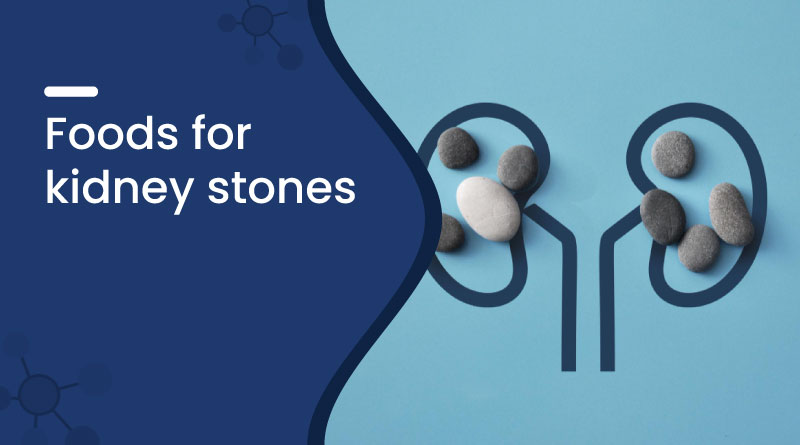 Best Foods for Kidney Stones