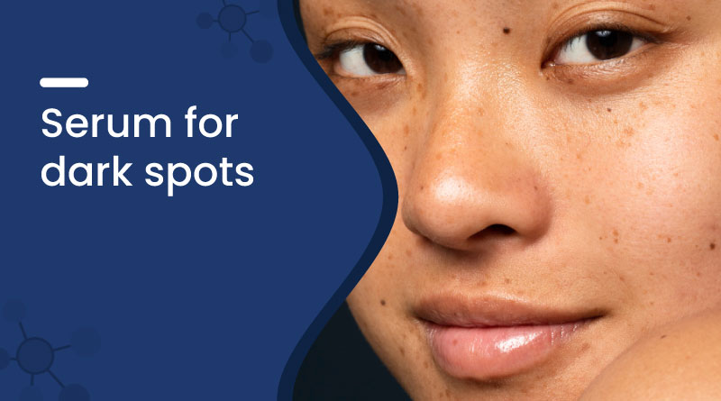 Best Serum for Dark Spots &ndash; Clear & Brighten Skin