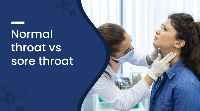 Normal Throat vs Sore Throat | Key Differences & Symptoms