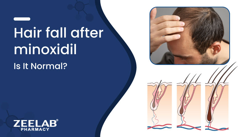 Image of Minoxidil Shedding phase