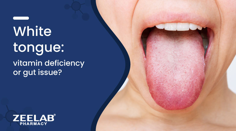 https://www.zeelabhealth.com/public/uploads/blogs/white-tongue-causes-vitamin-deficiency-gut-problems.jpg