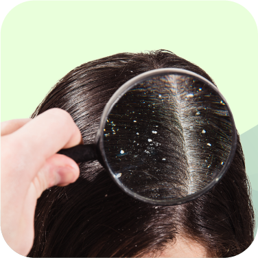anti-dandruff